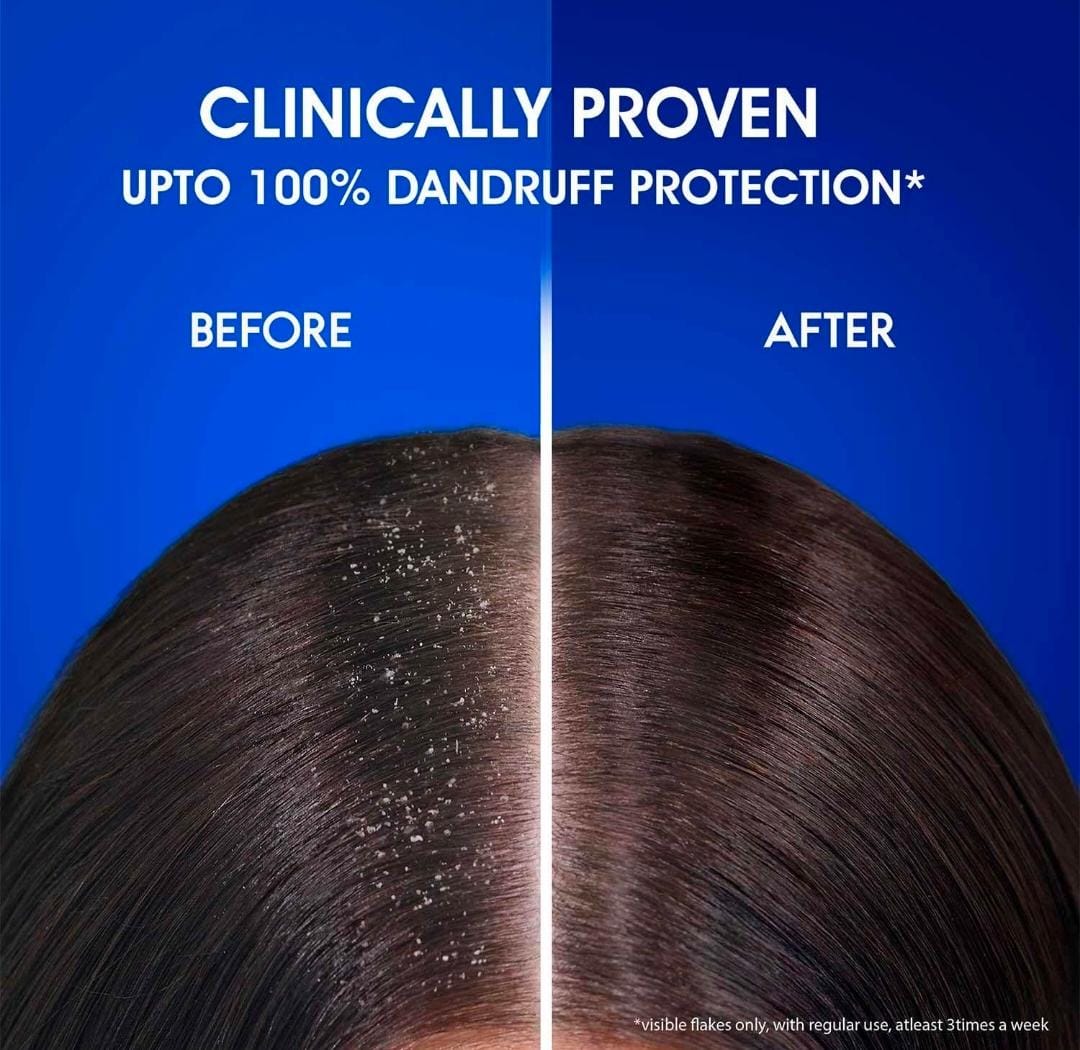 Head & Shoulders Smooth and Silky Shampoo, 200ml